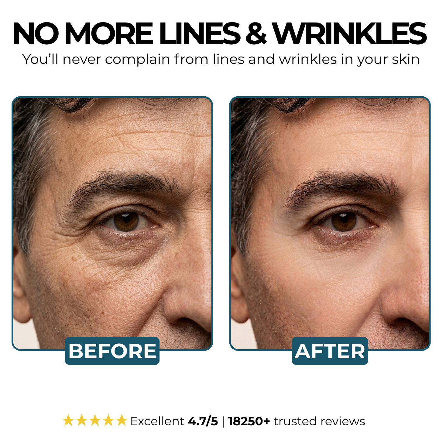 Vorexilglow-anti-aging cream