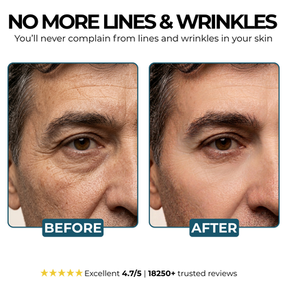 Vorexilglow-anti-aging cream