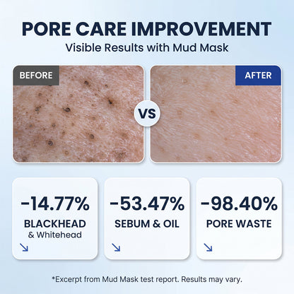 Zero Pores Blackhead Mud Mask-Free Pore Brush