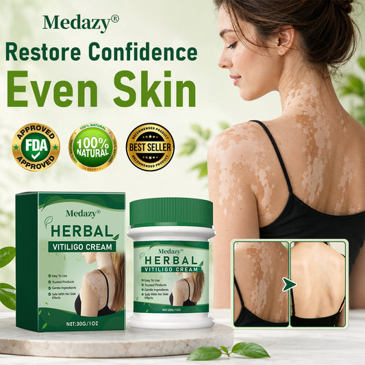 Medazy® Herbal Vitiligo Cream