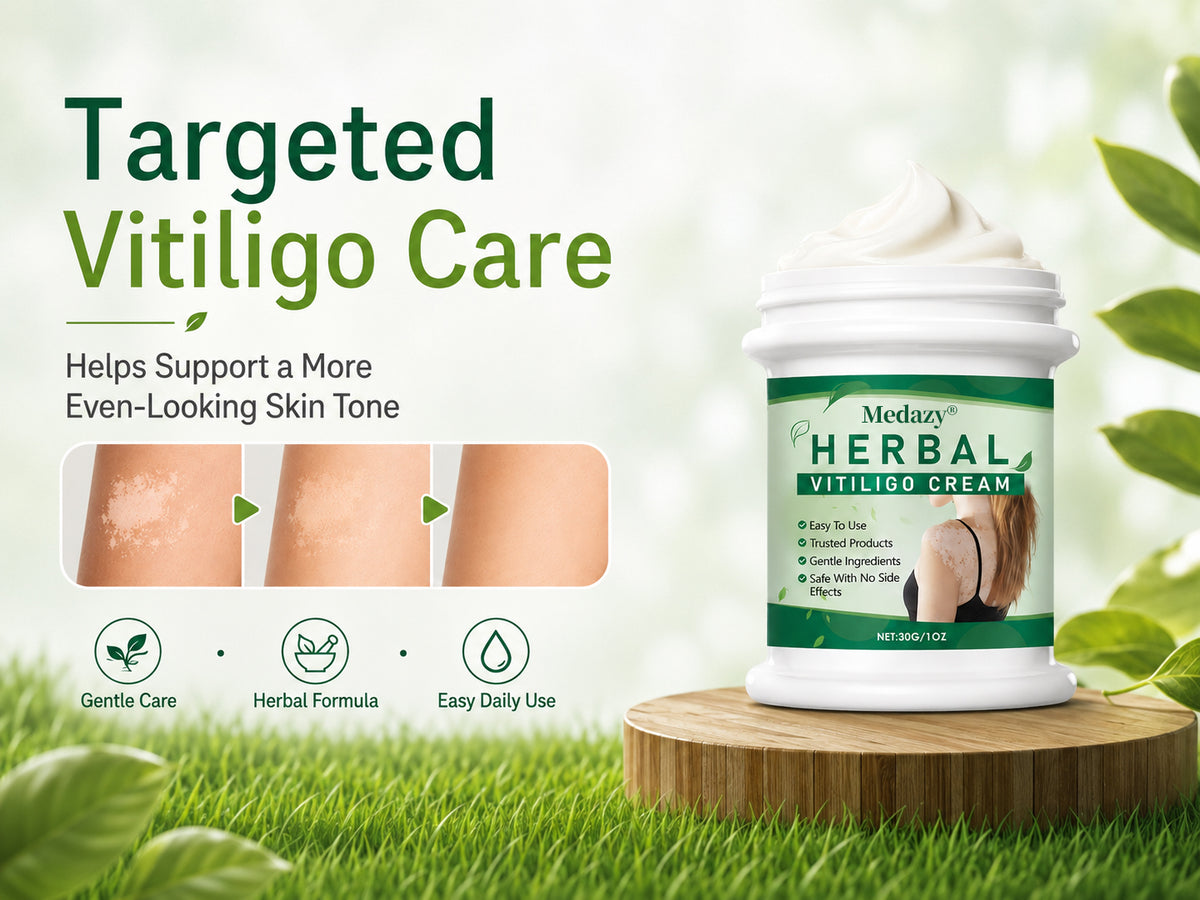 Medazy® Herbal Vitiligo Cream