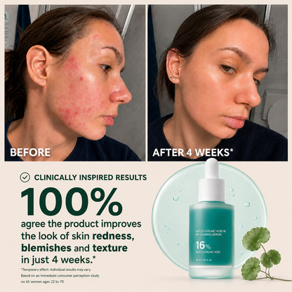 Avlunexa Anchoic Acid Soothing Serum
