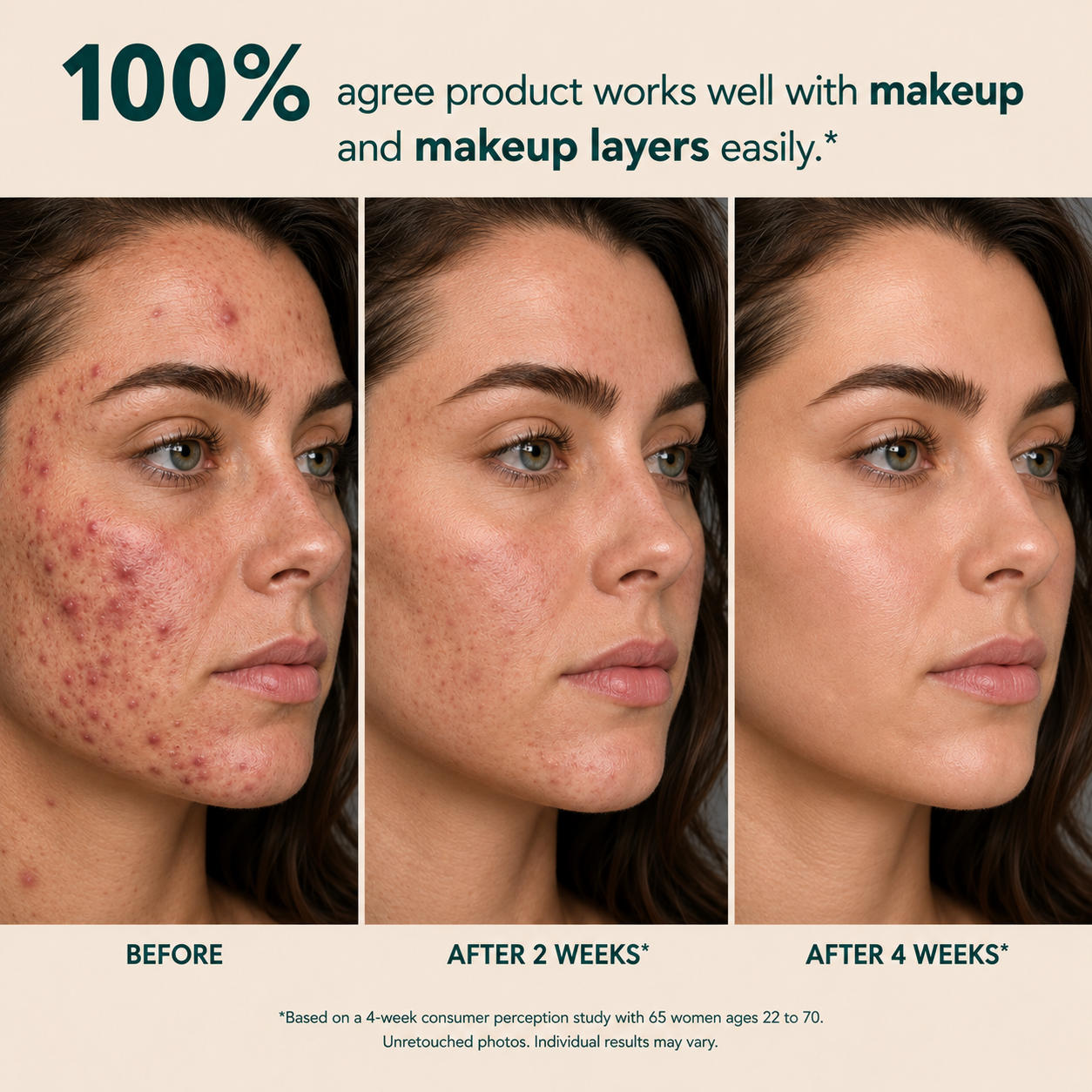 Avlunexa Anchoic Acid Soothing Serum