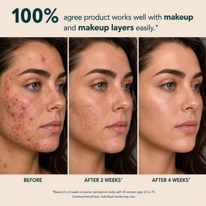 Avlunexa Anchoic Acid Soothing Serum