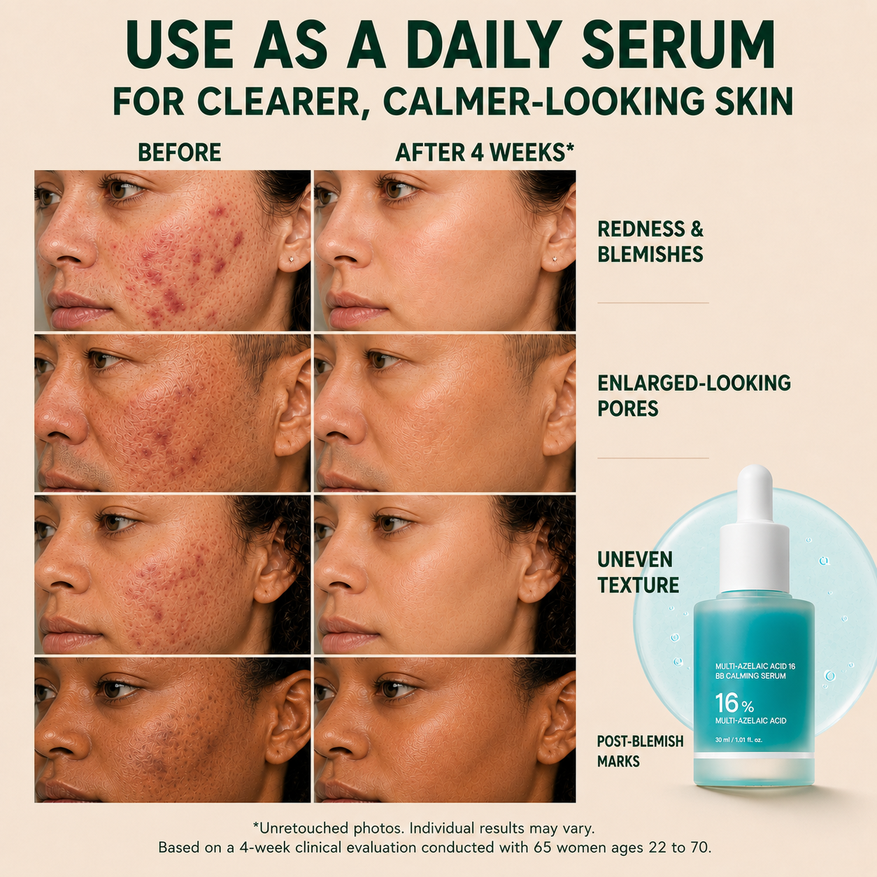 Avlunexa Anchoic Acid Soothing Serum