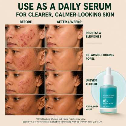 Avlunexa Anchoic Acid Soothing Serum