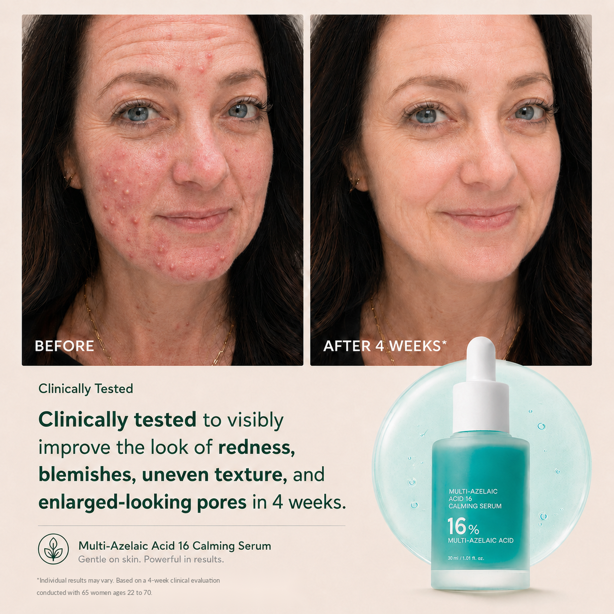 Avlunexa Anchoic Acid Soothing Serum