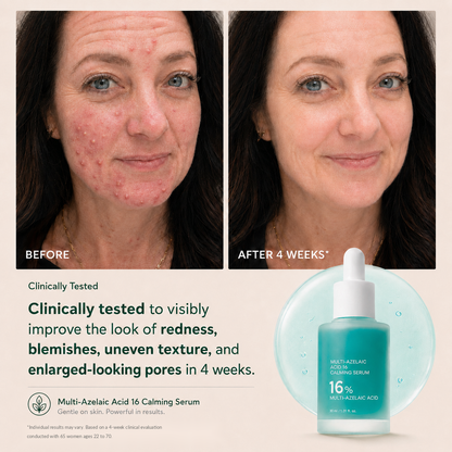 Avlunexa Anchoic Acid Soothing Serum